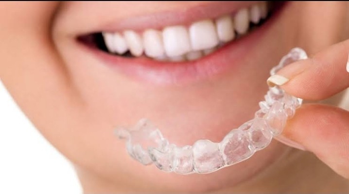 What happens in an examination of Invisalign?